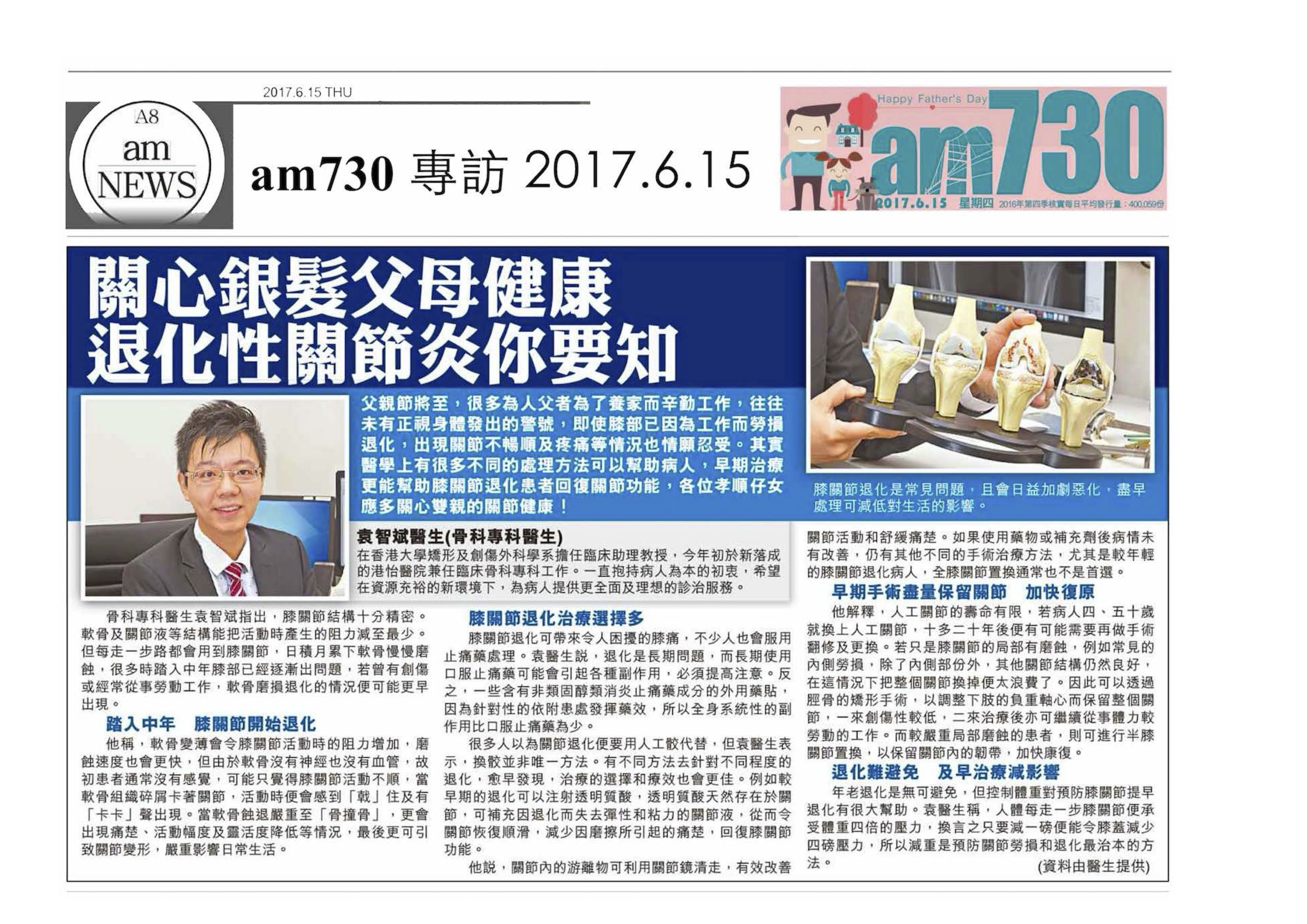 膝關節退化及關節痛症示意照片