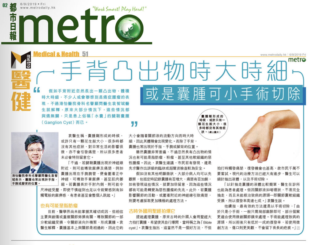 手背凸出物時大時細 或是囊腫可小手術切除