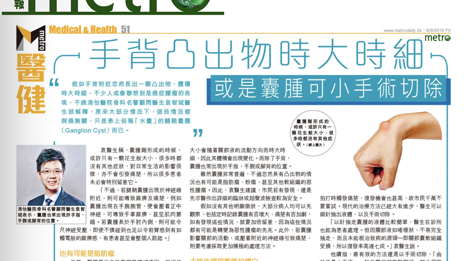 手背凸出物時大時細 或是囊腫可小手術切除