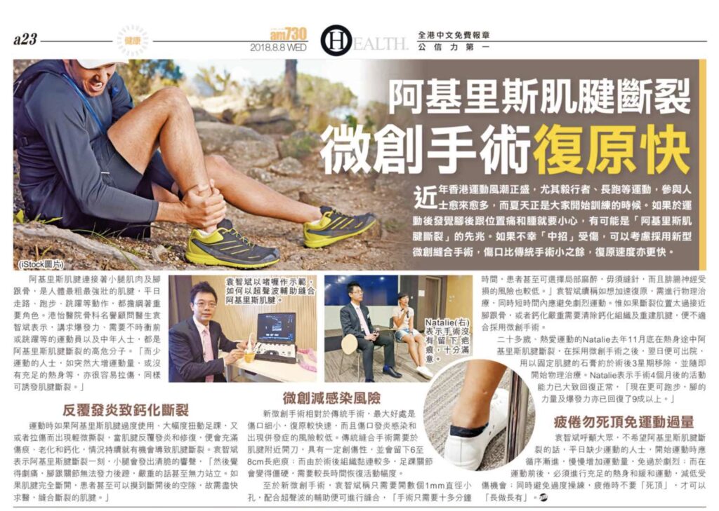 阿基里斯肌腱斷裂 微創手術復原快