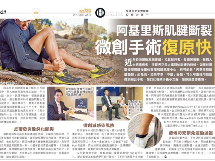 阿基里斯肌腱斷裂 微創手術復原快