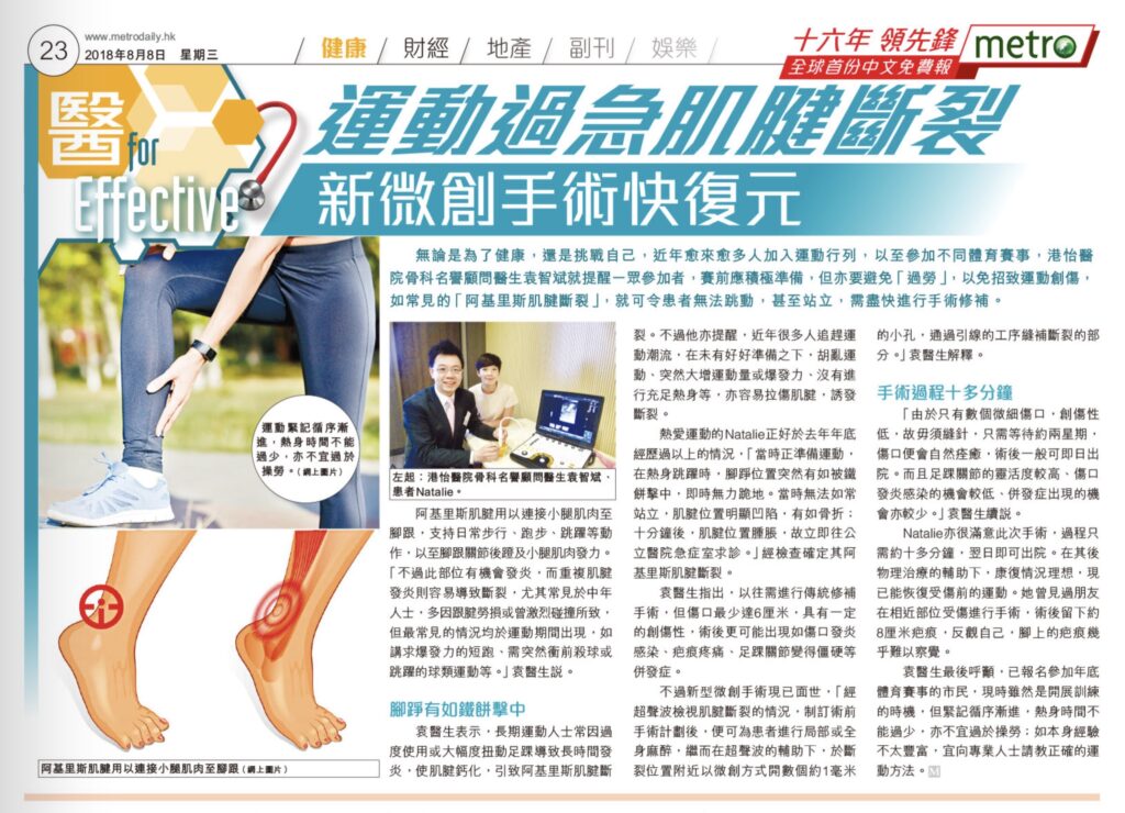 運動過急肌腱斷裂 新微創手術快復元