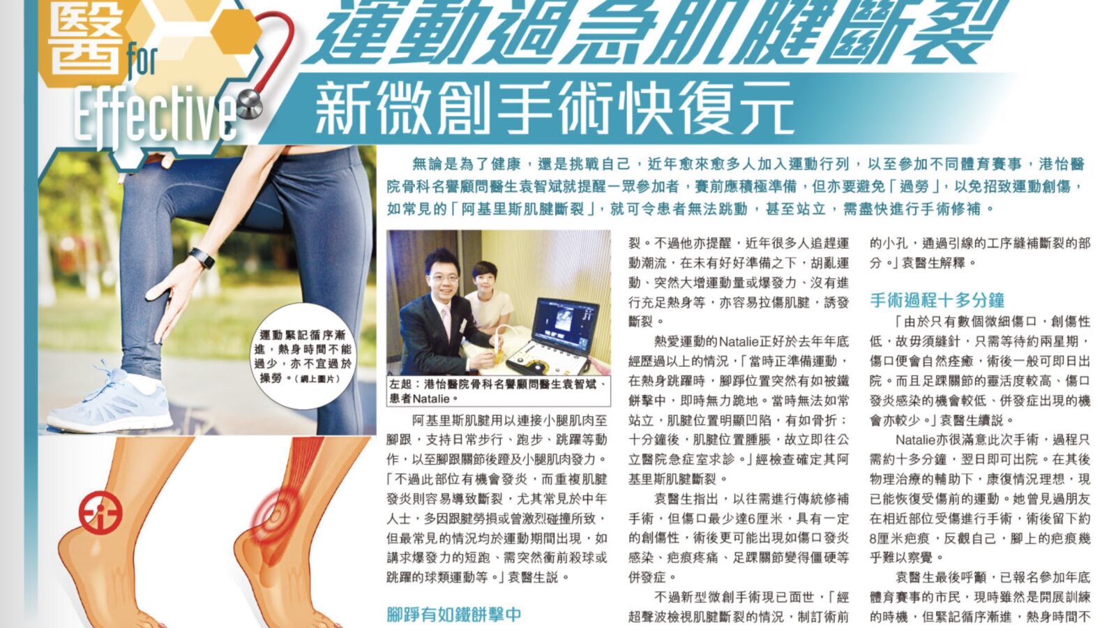 運動過急肌腱斷裂 新微創手術快復元