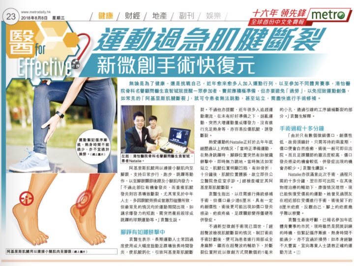 運動過急肌腱斷裂 新微創手術快復元