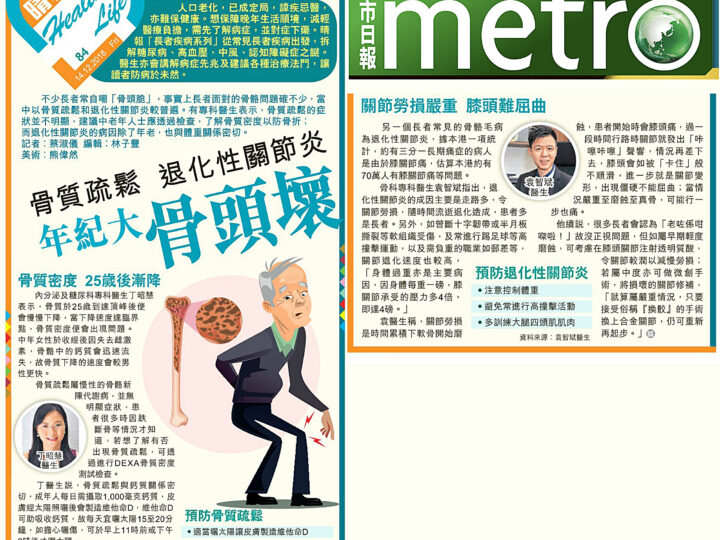 骨質疏鬆 退化性關節炎 年紀大骨頭壞